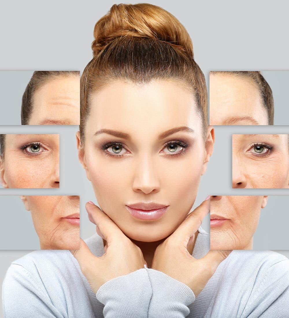 Dermal filler treatment areas for natural-looking facial balance