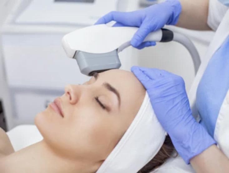 IPL Treatments treatment in New Braunfels and Spring Branch, TX