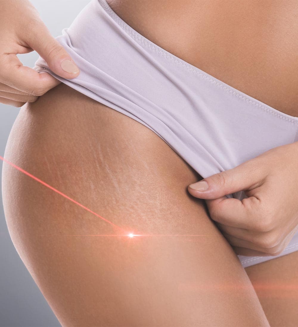 Laser treatment detail at Uplifting Medi Spa