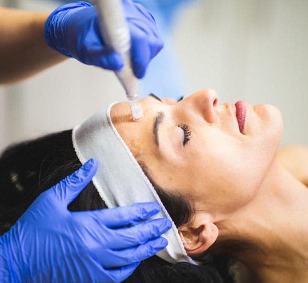 Microneedling Services treatment in New Braunfels and Spring Branch, TX