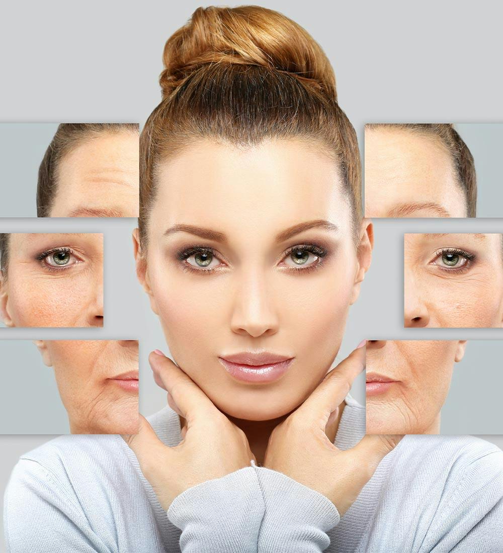 woman with dermal fillers in new braunfels and spring branch texas