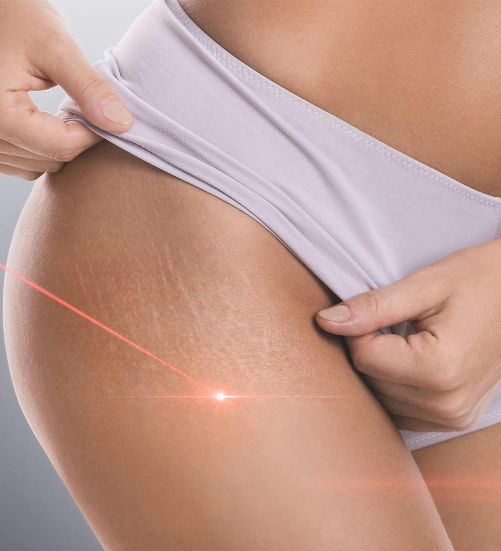 laser treatments detail in new braunfels and spring branch texas